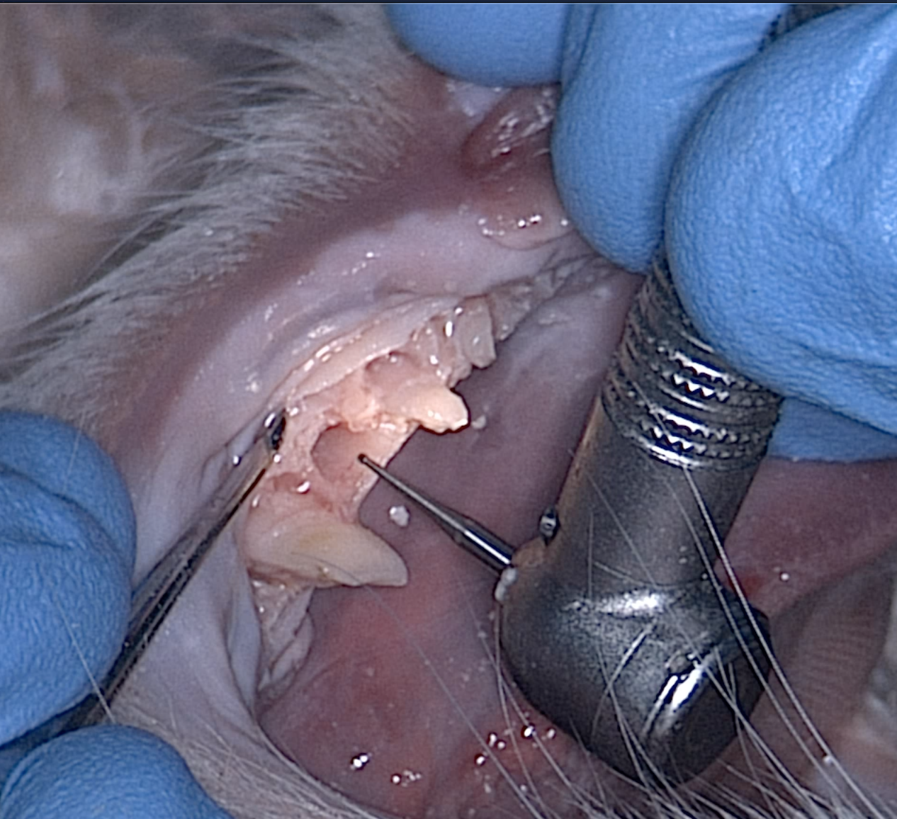 Use of high speed handpiece and bur